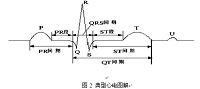 基于FPGA的数字式心率计.