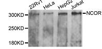 糖皮质激素对牛NCOR1基因转录活性调控作用研究