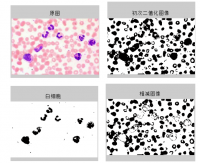 基于matlab数字图像处理技术红细胞计数检测系统设计